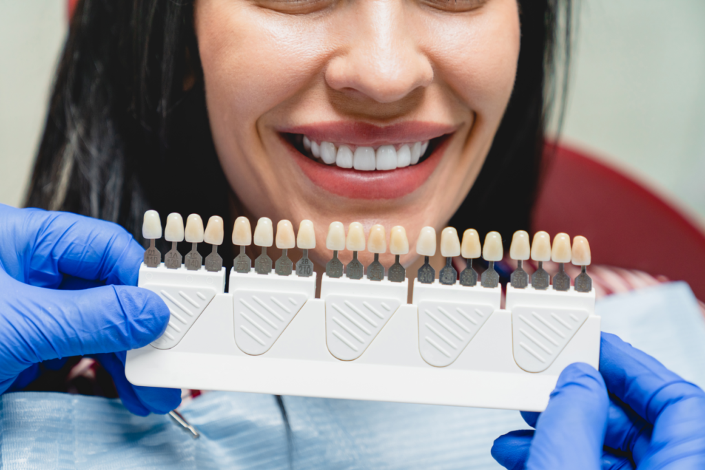 Lors d'une pose d'un implant dentaire, vous pouvez choisir une prothèse adaptée à votre dentition.